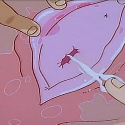 Anime に 'Kink' ドリームハザード (サムネイル 4)