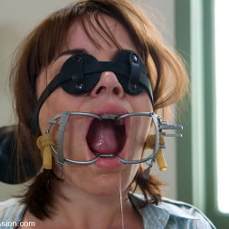 Dana DeArmond に 'Kink' 歯の支配 (サムネイル 2)