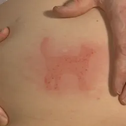 Siouxsie Q en Estampado de piel: formas creativas de dejar tu marca (foto 14) Siouxsie Q en 'Kink' Estampado de piel: formas creativas de dejar tu marca (Miniatura 14)